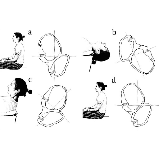 How to remove a double chin