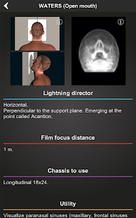 RX - Radiographic Positioning  Screenshots 9