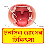 টনসঠল রোগের চঠকঠৎসা ~ Tonsil Disease Treatment icon