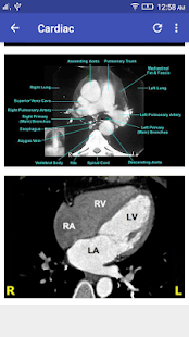 CT Scan Cross Sectional Anatomy screenshots 6