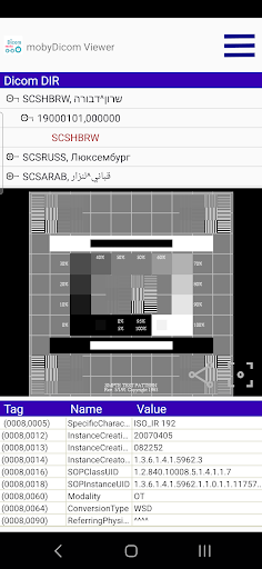 mobyDicom - DICOM Viewer Screen 2
