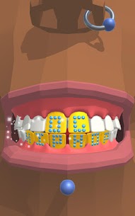 Dentist Bling MOD APK 0.9.5 (Unlimited Money) 5