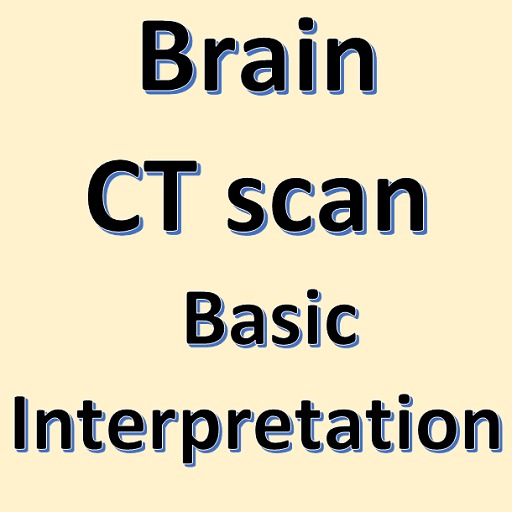 Brain CT Scan Interpretation