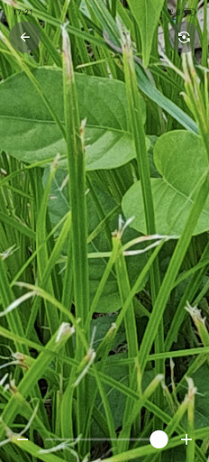 EyeLite Zoom Camera and Light