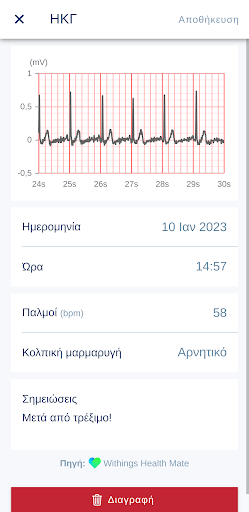CardioFit Screen 2