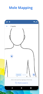 SkinVision - Detect Skin Cancer. Track your Moles. 6.10.0 Screenshots 4
