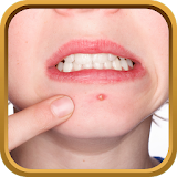Acne Treatments Guide icon