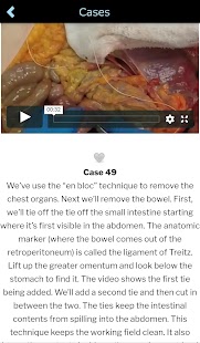 Autopsy Bildschirmfoto