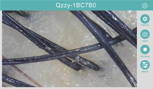 Qzzy Screen 3