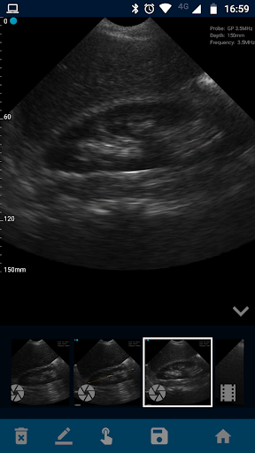 Android application VistaScan Ultrasound App screenshort