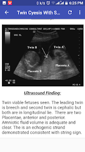 Ultrasound Guide A2Z