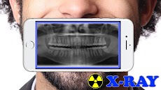 X-Ray Filter Photoのおすすめ画像2