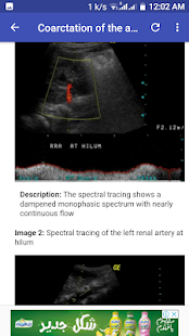 Ultrasound Guide A2Z