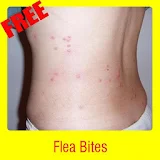 Flea Bites icon