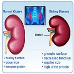 All kidney diseases and Treatment Apk