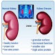 All kidney diseases and Treatment Download on Windows