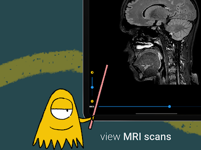 icompanion: understand your MS