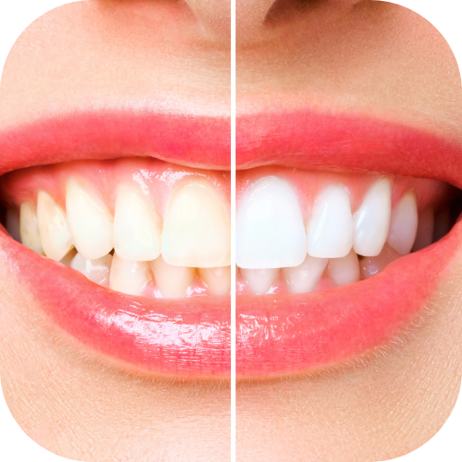 teeth whitening Download on Windows