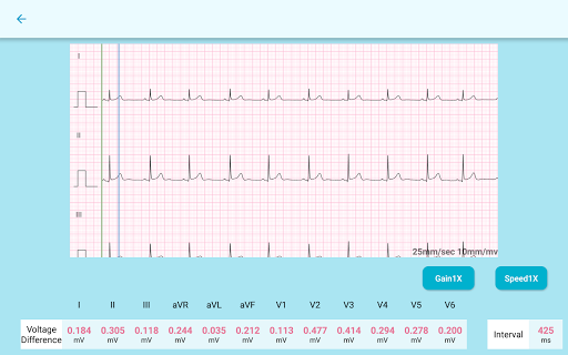 Android application QT ECG Lite screenshort