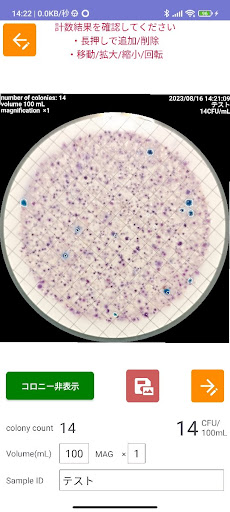 E. coli Colony Counter Screen 3