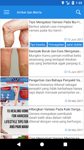 Varises Indonesia Screen 2
