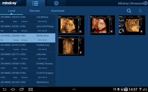 MedSight HD Screen 3