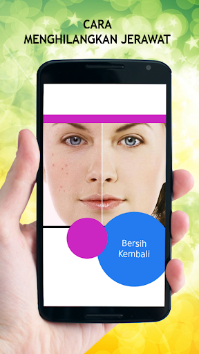 Cara Menghilangkan Jerawat