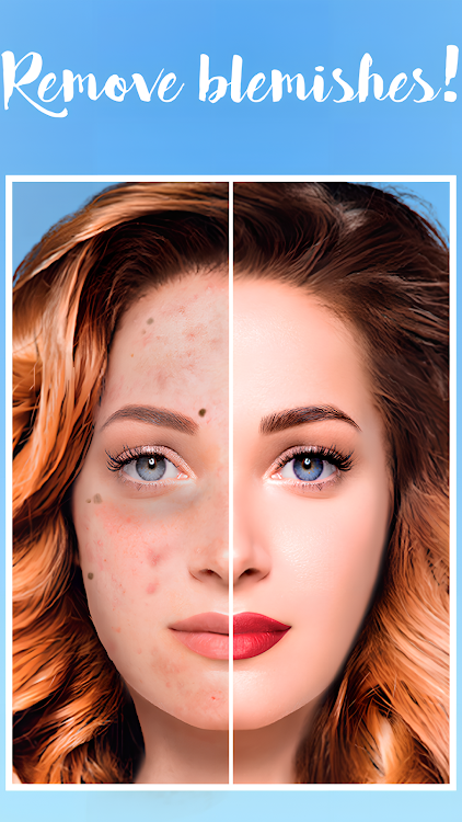 Blemishes Removal - New - (Android)