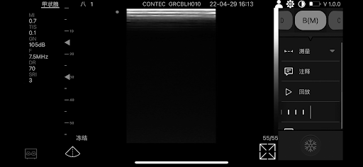 Android application CMS1600-VET screenshort