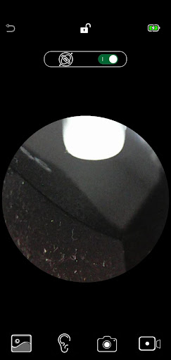 EarView Screen 2