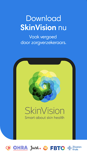 SkinVision - herken huidkanker