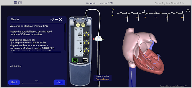 Medtronic VirtualEPG Unknown