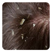 Dry Scalp Guide