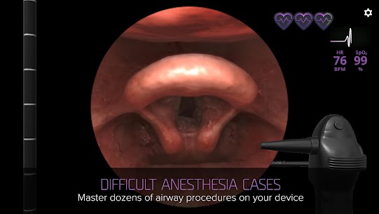 Airway Ex: Anesthesiology Game 2