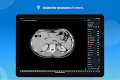 screenshot of e-Anatomy