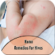 Home Remedies For Hives Download on Windows