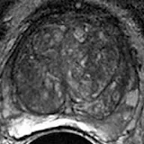 PI-RADS Prostate MRI icon