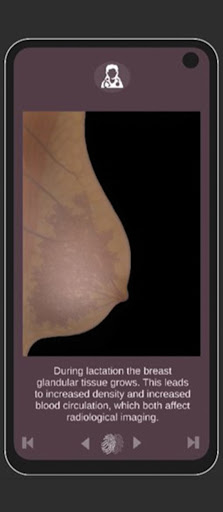 Insight into Breast Imaging Screen 3