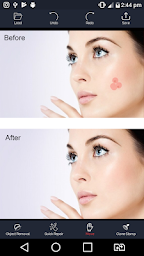 Photo Retouch - Blemish Remove