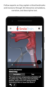 Captura de Pantalla 4 Smile Train android