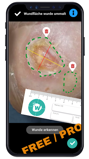 WUNDERA® Wundmanagement Screen 3