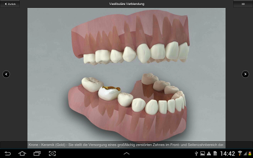 CGM VISODENT 3D App Screen 3