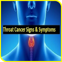 Signs of Throat Cancer