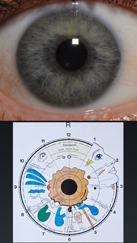 Eye Diagnosisのおすすめ画像3