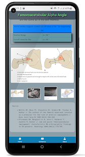 Orthopedic Measures App