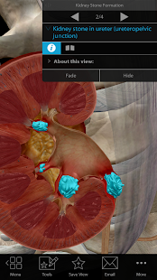 Physiology & Pathology(圖4)-速報App