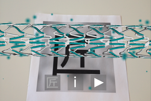 Terumo DES Screen 2
