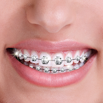Cover Image of Download Fake Braces Camera with Photo Stickers for Teeth 1.5 APK
