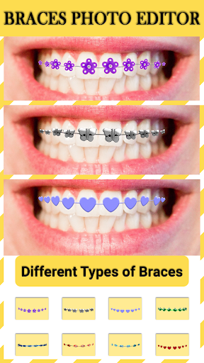 Braces  Add Braces On Photo