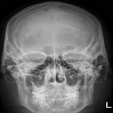 Human X-ray Anatomy icon